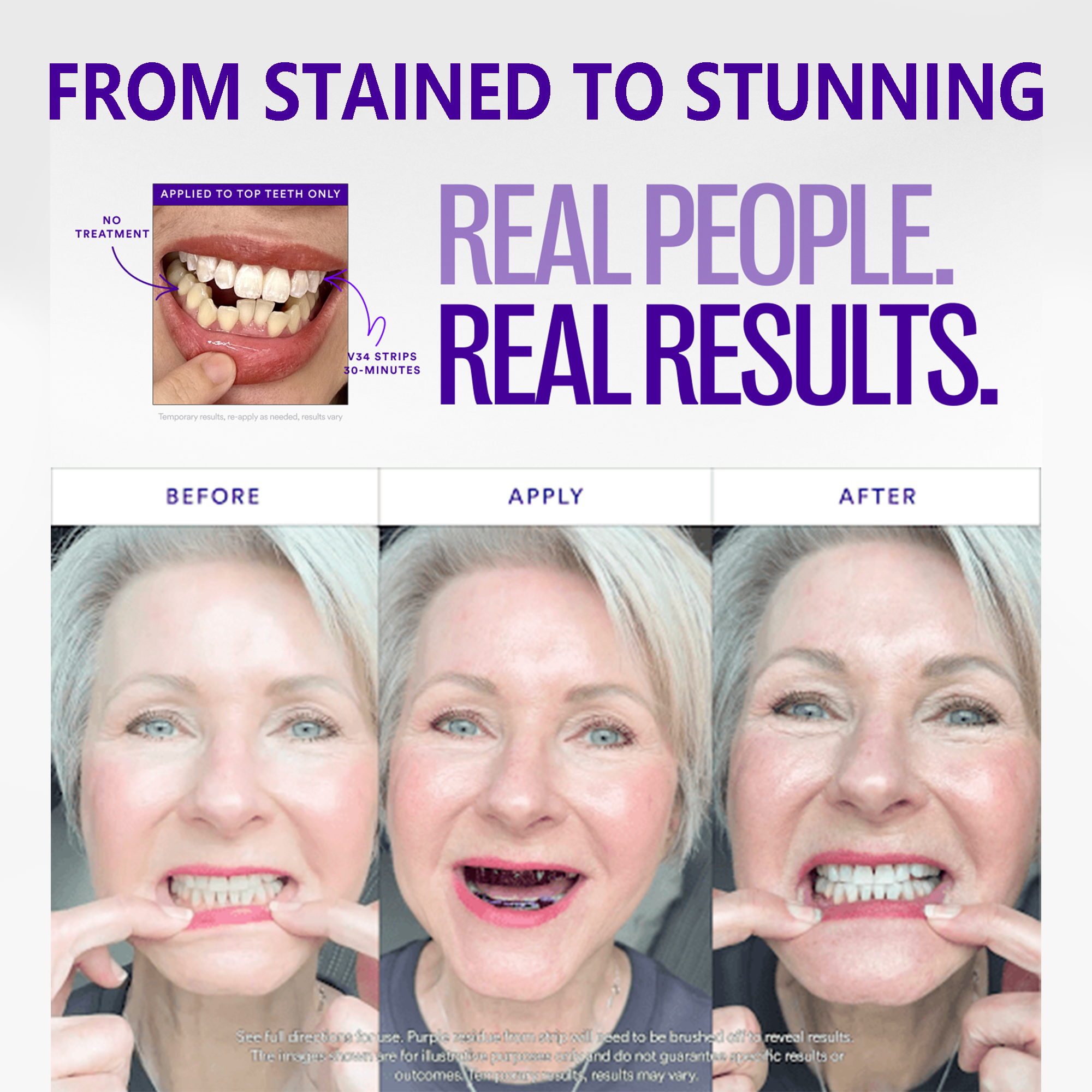 V36 Whitening Strips – Professional Teeth Whitening at Home