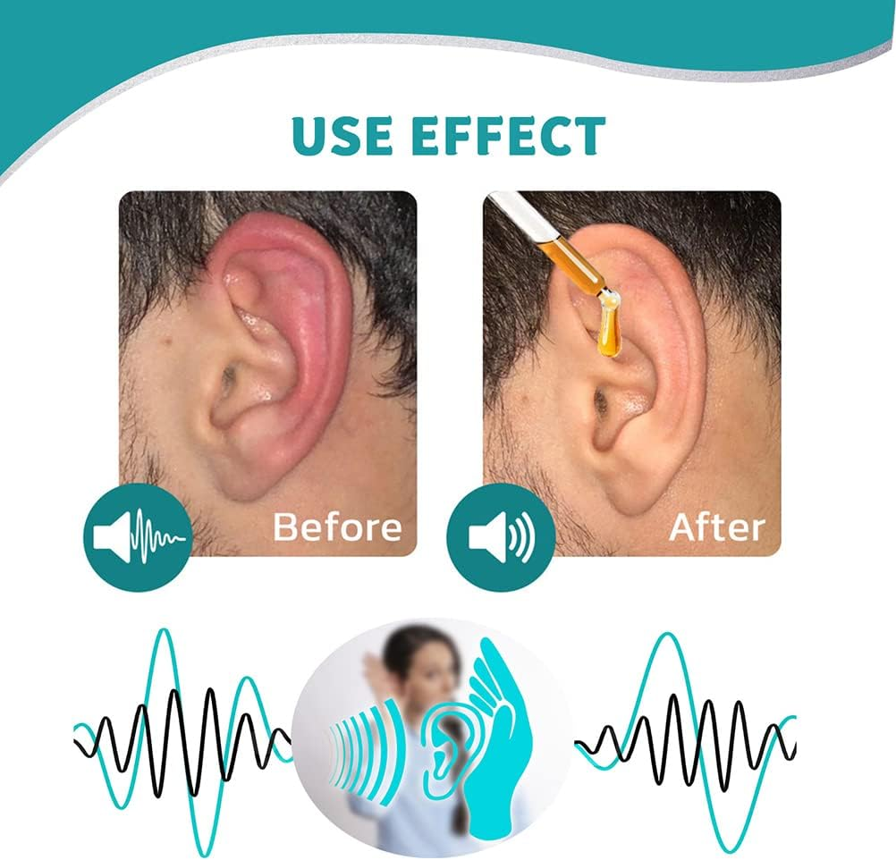 ✨FDA Registered – Ear Care Drops – Plant Based Formula