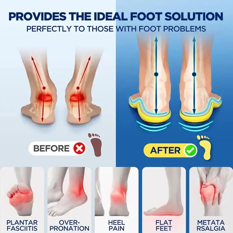 All-Day Comfort Insoles with Shock Absorption & High Arch Support