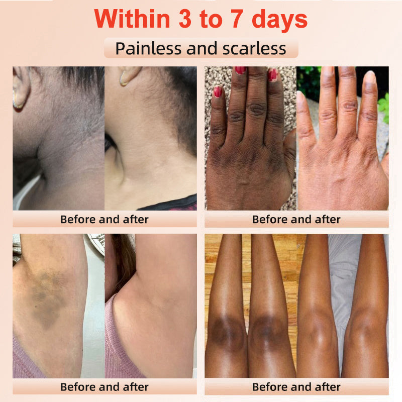 ✨[Official Store]JEREMYTIS™ Exfoliating Gel