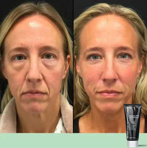 Temporary Face Tightener (🎁Buy More Save More）