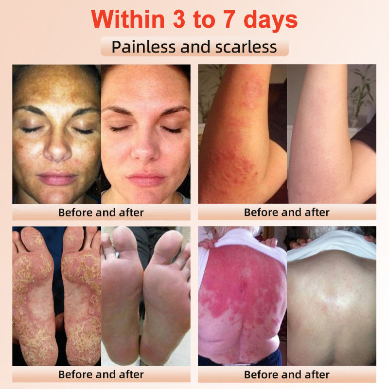 ✨[Official Store]JEREMYTIS™ Exfoliating Gel