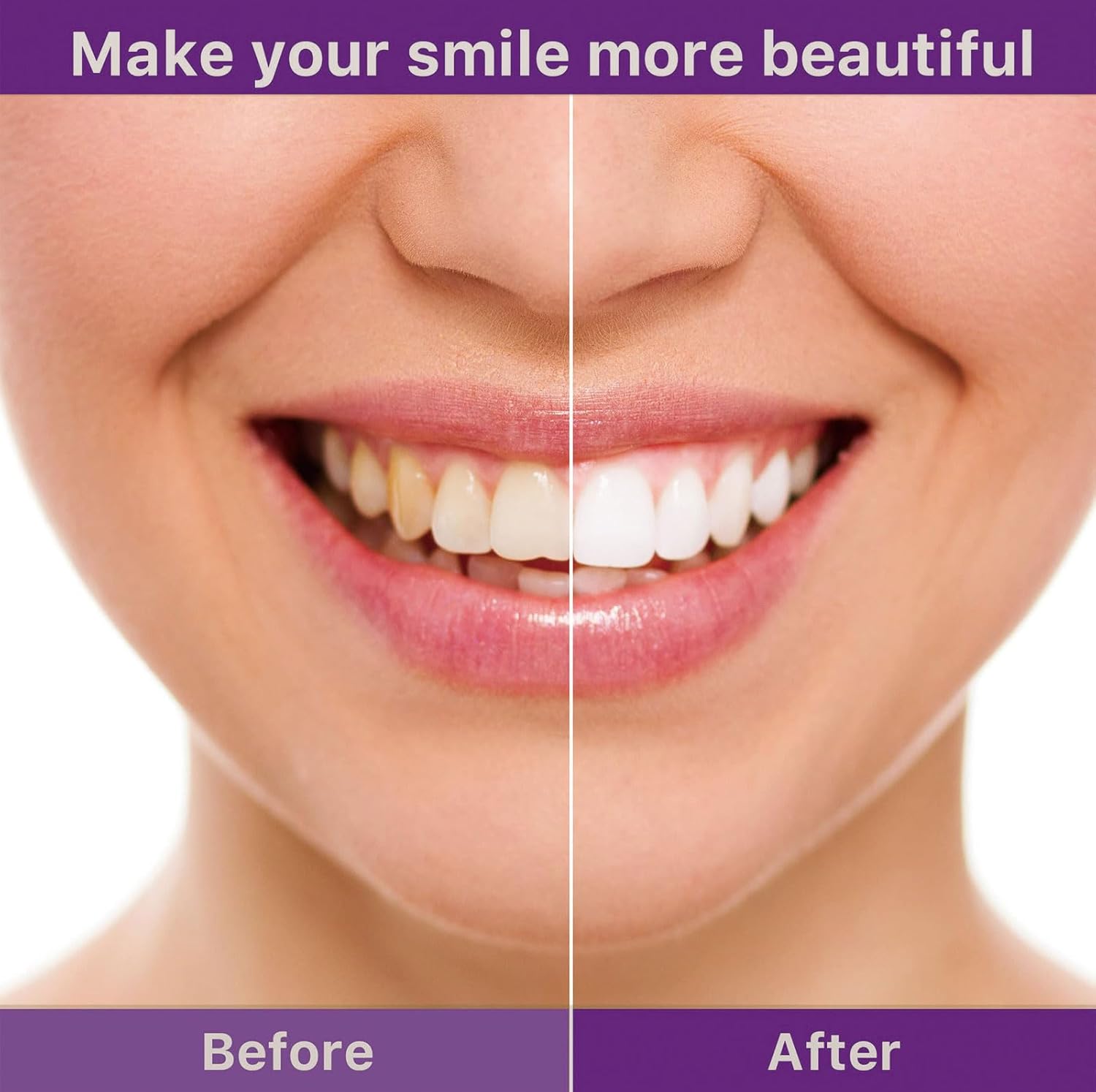 🔥V36 Whitening Strips – Professional Teeth Whitening at Home