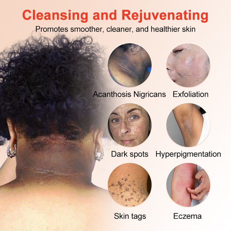 ✨[Official Store]JEREMYTIS™ Exfoliating Gel