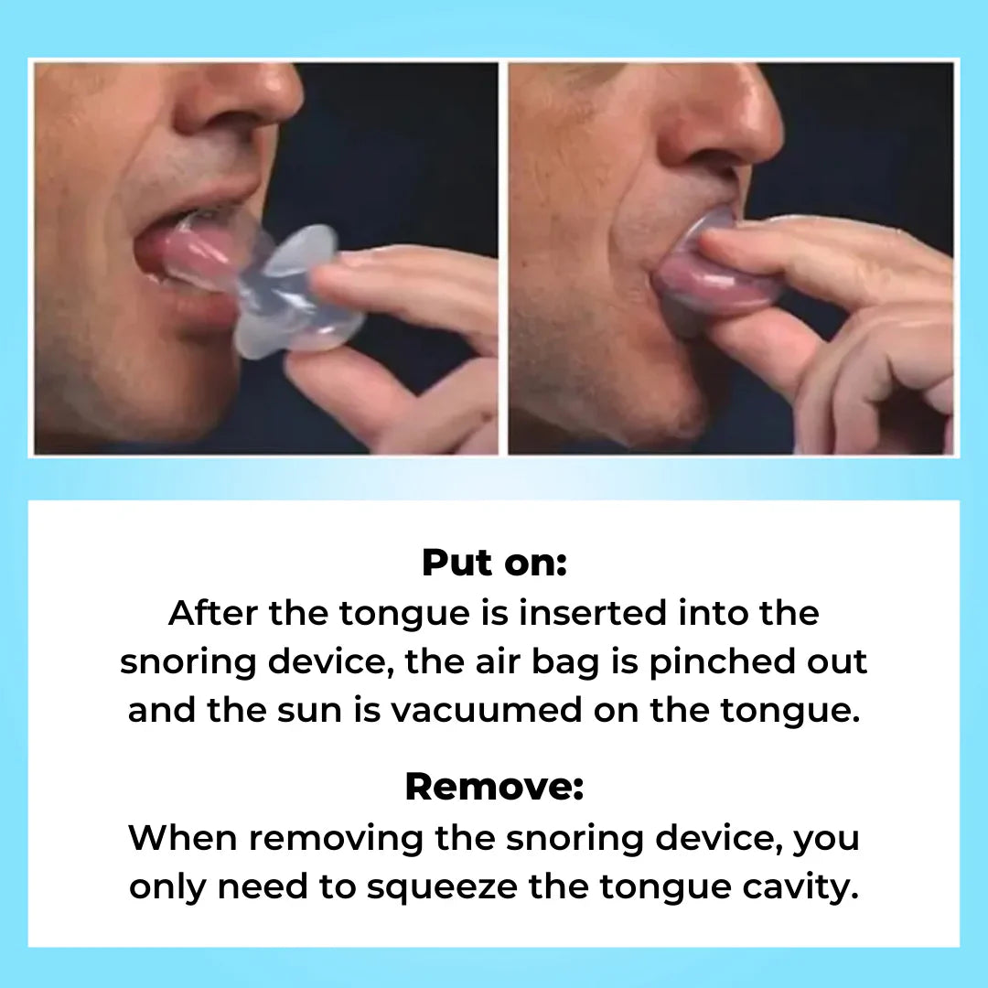 [Official Store]JEREMYTIS™ - Anti Snoring Device