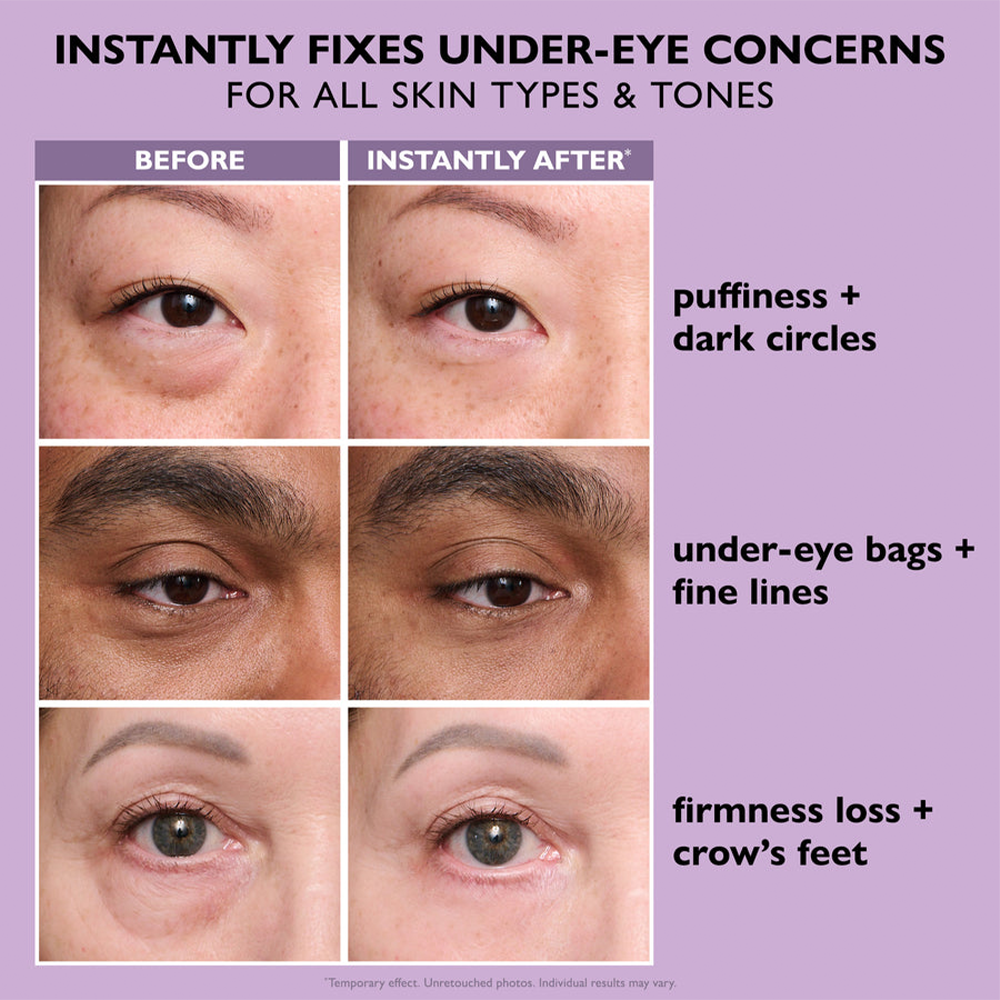 Eye Tightener Cream